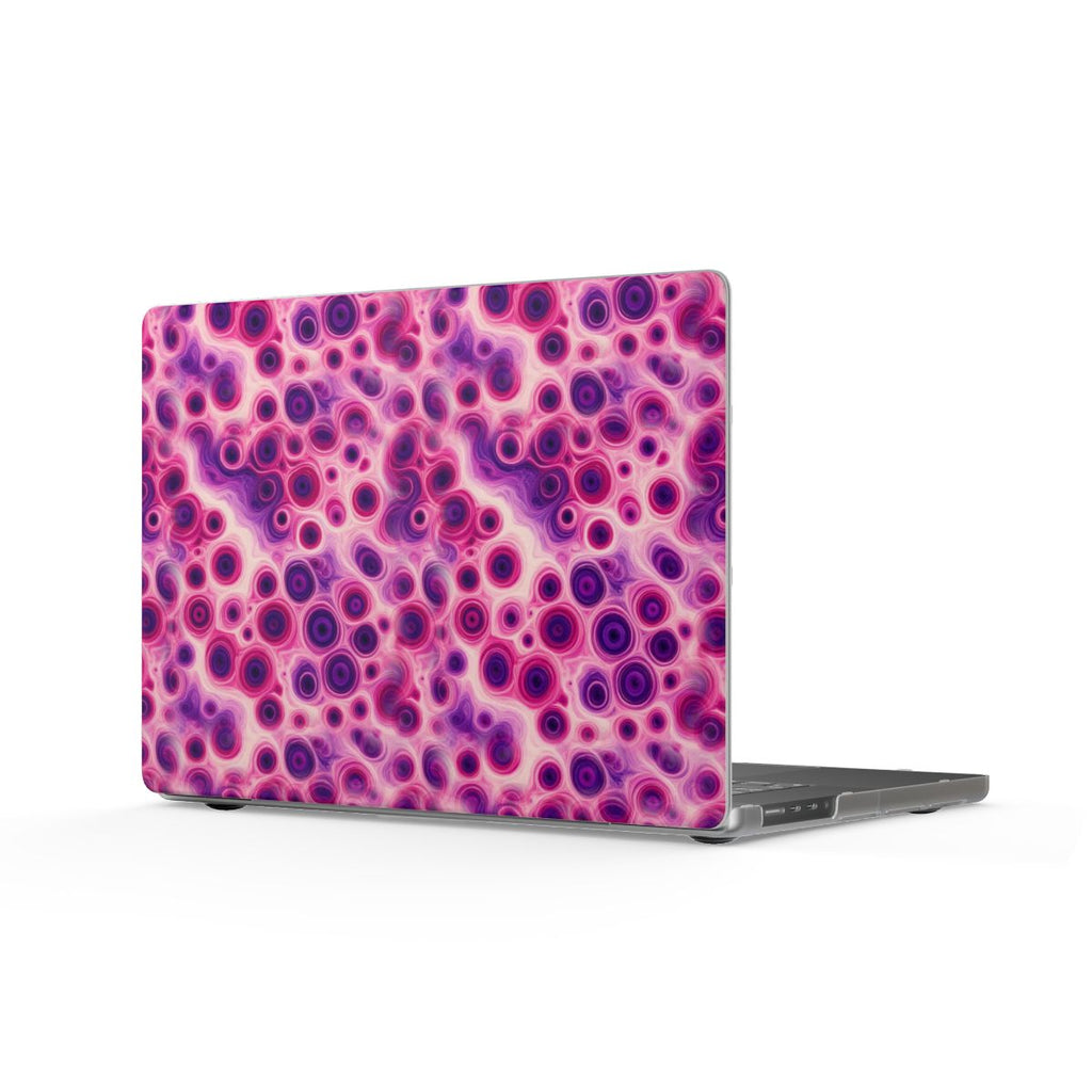 Berry Puddle Pour Matte MacBook Case – MacBook Pro 16