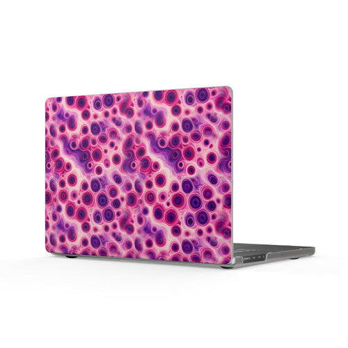 Berry Puddle Pour Matte MacBook Case – MacBook Pro 16